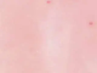 Camsoda Nude Webcam of daleskasanchez